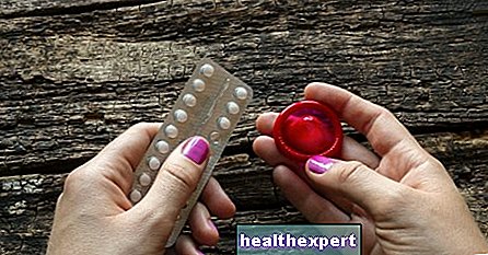 Métodos anticonceptivos: ¿cuál es el adecuado para usted?