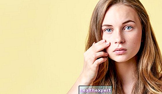 Ácido salicílico facial: el aliado para combatir eficazmente el acné y las espinillas - Belleza