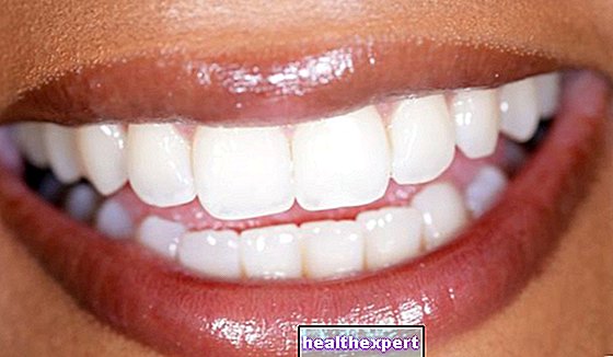 How to whiten teeth with baking soda: a natural whitener - Beauty