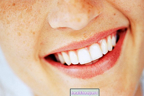 Dişlerinizi beyazlatmak ve temizlemek için hindistancevizi yağı nasıl kullanılır - Güzellik