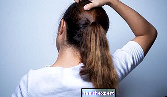 Dolor de cuero cabelludo: remedios para el ardor y la picazón