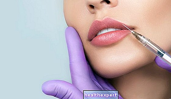 Pengisi bibir: semua yang anda perlu ketahui mengenai rawatan ini
