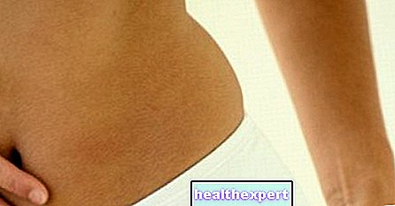 Liposculpture to eliminate excess fat