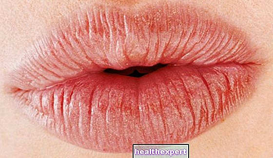 Uuesti muudetud huuled: volüümse hoolduse plussid ja miinused