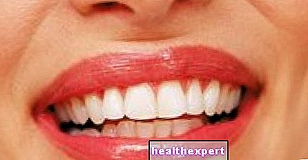 Teeth whitening - Beauty