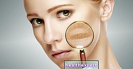 Κηλίδες δέρματος: οι καλύτερες φυσικές θεραπείες για την καταπολέμησή τους - Ομορφιά