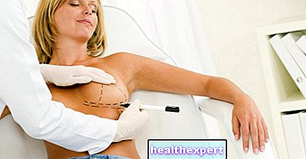 Mastoplastik: Arten, Eingriffe und Ziele der plastischen Brustchirurgie