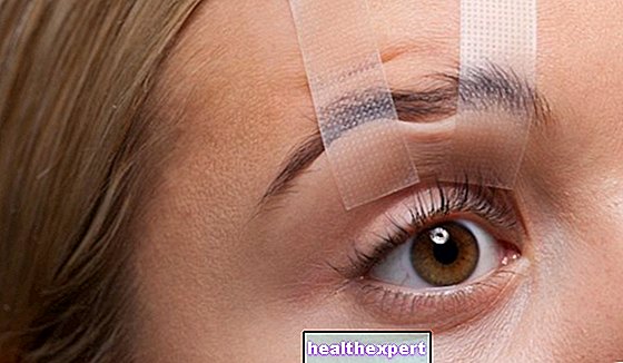 Göz kapağı sarkması: Göz kapağı düşüklüğünün nedenleri ve çareleri