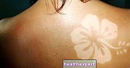 Sun Tattoo: sommerens nye trend er soltatoveringen som er populær på sosiale nettverk