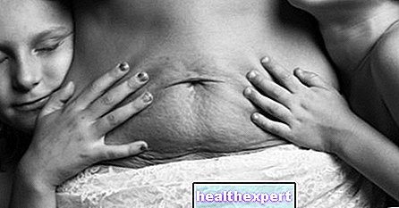 Młode matki nago: piękno ciała kobiet po porodzie bez retuszu