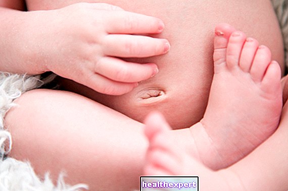 Pupeční kýla u novorozence: příznaky, diagnostika a léčba