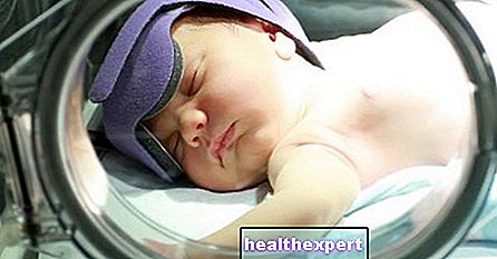 Neonatalna žutica: što je to, koji su uzroci i preporučeno liječenje
