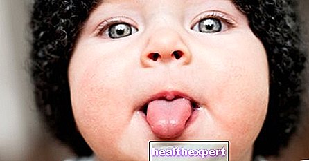 Pienligė naujagimiui: burnos kandidozės simptomai, gydymas ir profilaktika - Tėvystė