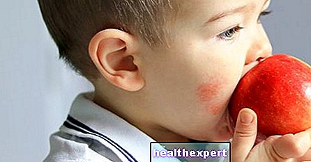 Ötödik betegség: gyermekek fertőző erythema tünetei, kezelése és megelőzése - Apaság