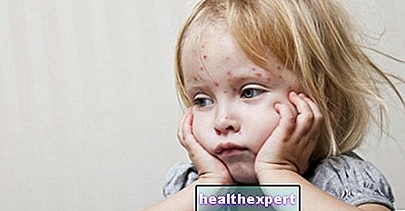 수두: 어린이들에게 가장 흔한 질병 중 하나의 증상, 진단 및 치료