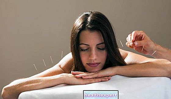 Akupunktúra: starodávna, ale veľmi diskutovaná technika