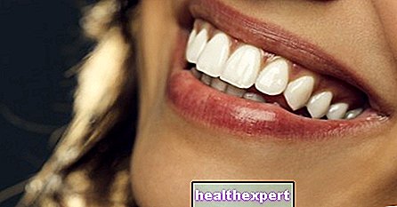 敏感な歯：原因と最も効果的な治療法 - 形状