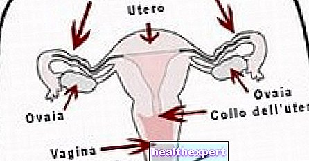 Ovarian cancer - In Shape