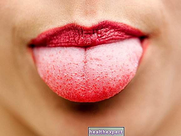 Spots on the tongue: what are the most common causes?