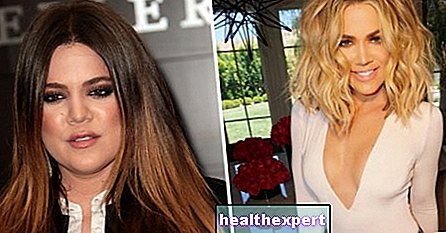 Khloè Kardashian ugjenkjennelig: det nye ansiktet til Kims søster, som i økende grad er fan av kosmetisk kirurgi - Nyheter - Gossip
