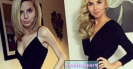 Gadis ini melawan anoreksia di Instagram dan ... dia keluar sebagai pemenang