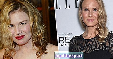 Renée, what have you done? The Zellweger unrecognizable due to the aesthetic touches!